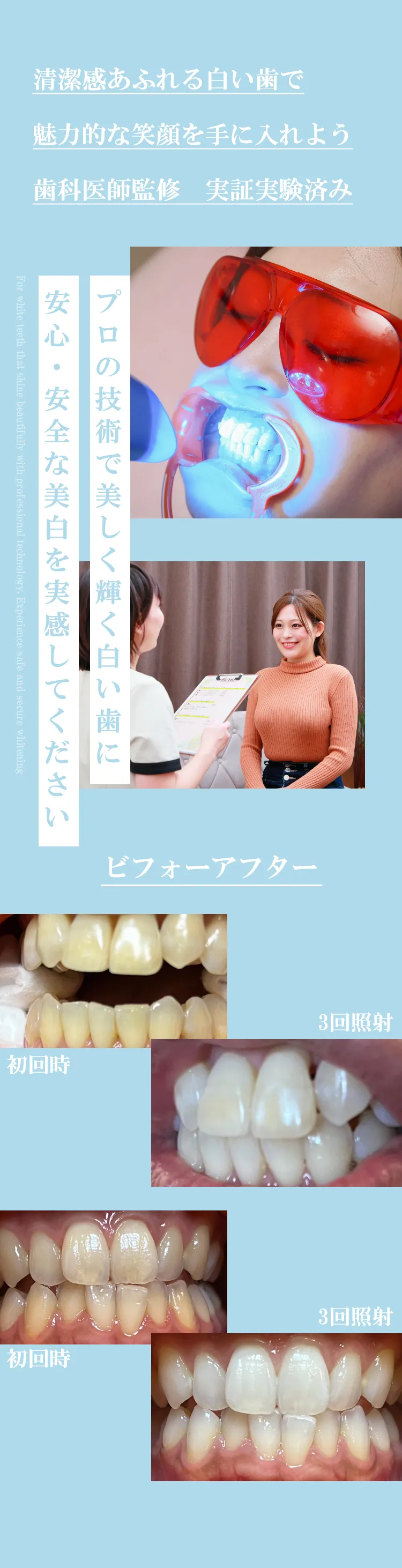 プロの技術で美しく輝く白い歯に